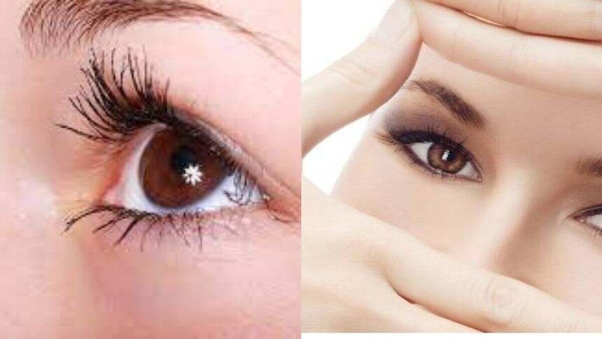Eye Care Home Remedies