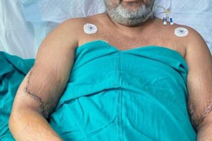 Ganga Ram Hospital Hand Transplant